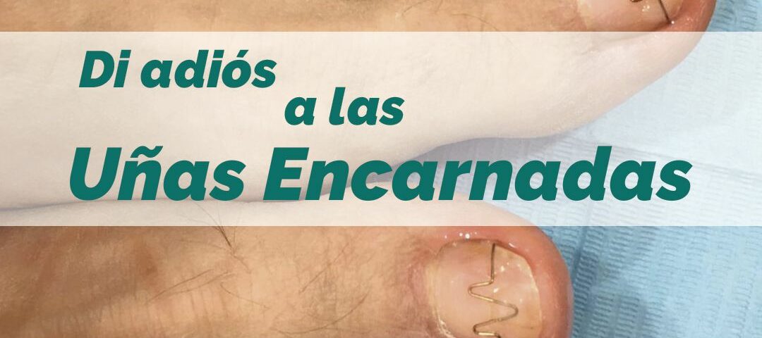 uñas_encarnadas-brackets-para-uñas-ortonixia
